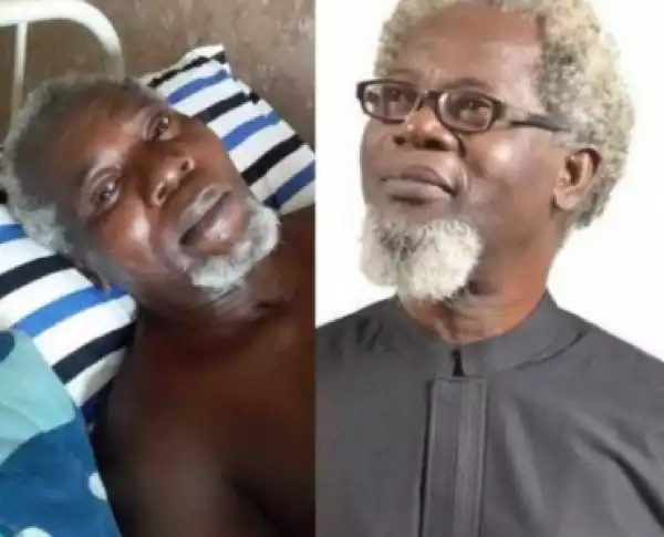 2 Years After, Actor Victor Olaotan Still Needs Money To Travel Abroad For His 2 Legs